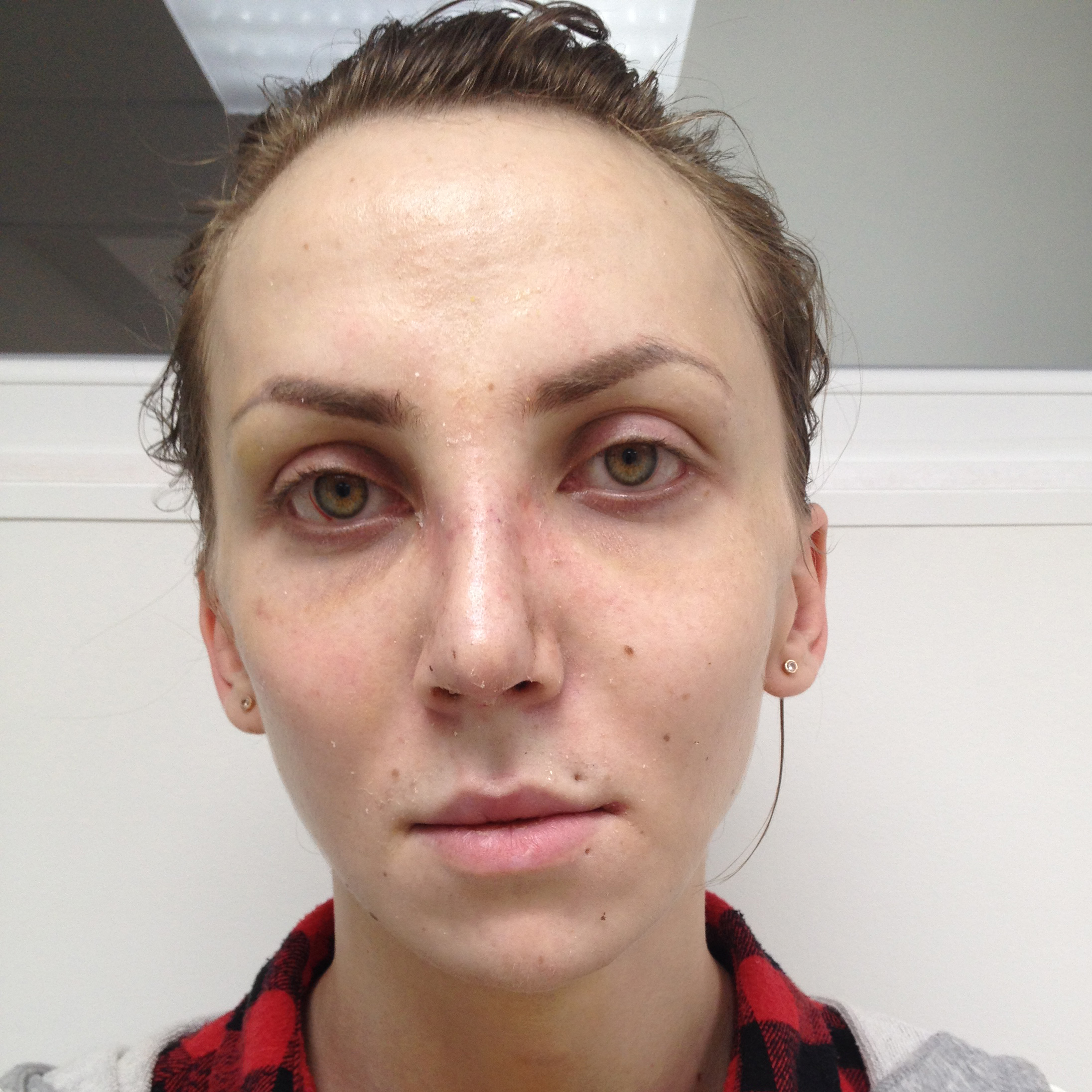 Феминизация сына. Операция по феминизации лица. Пластика лица феминизация лица. Феминизация пластика. Феминизация мужского лица