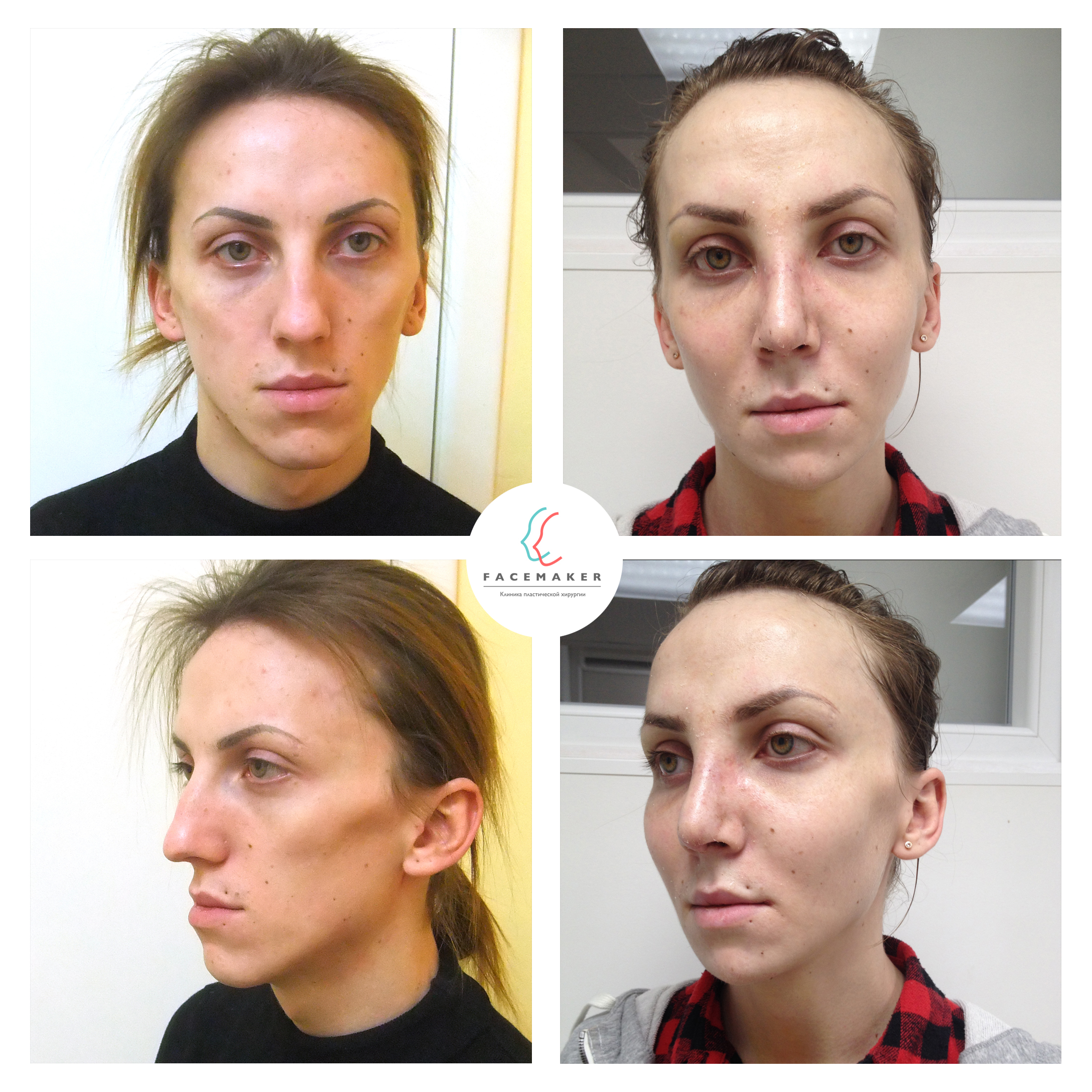 феминизация Феминизация V | facemaker.ru